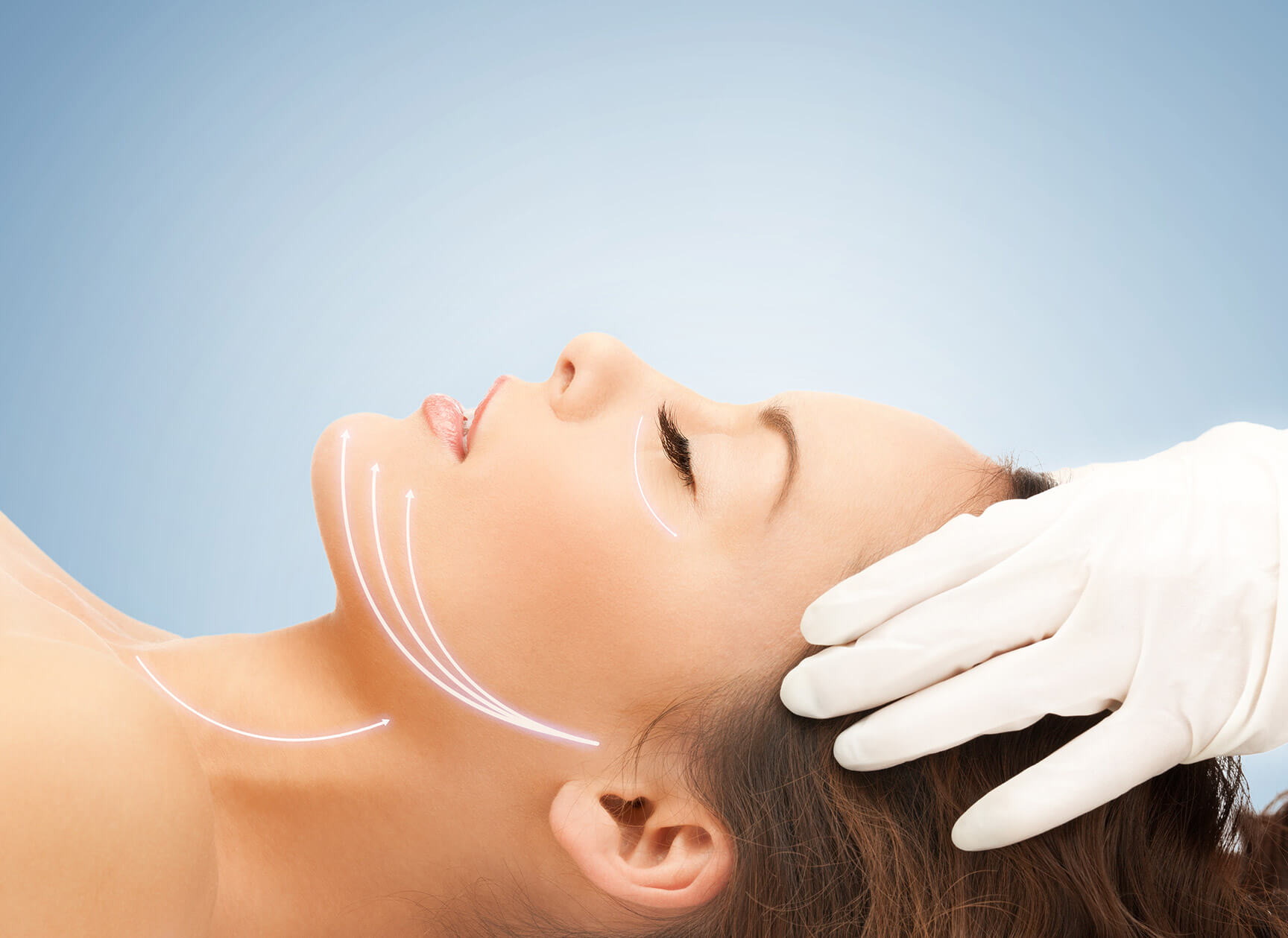 Facelifts