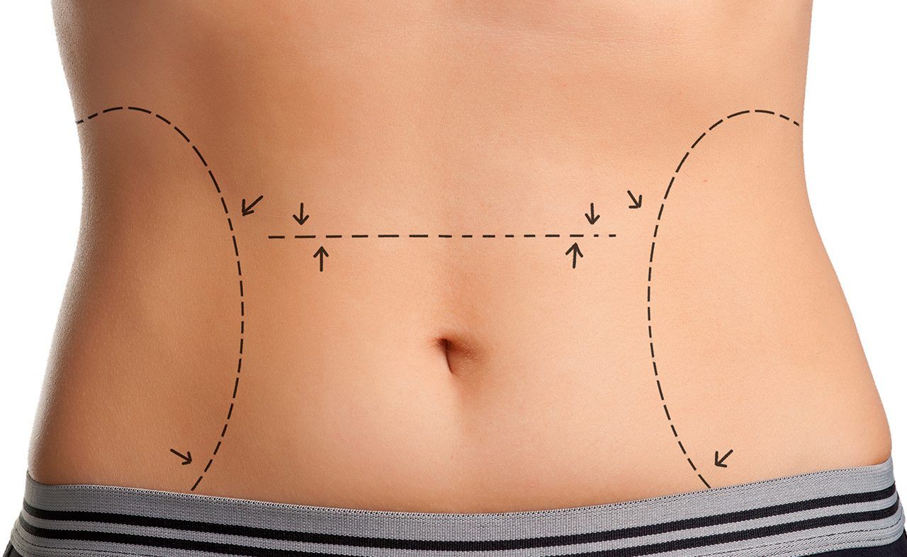 Dr. Benjamin Churchill on Free Plastic Surgery For Those in Need