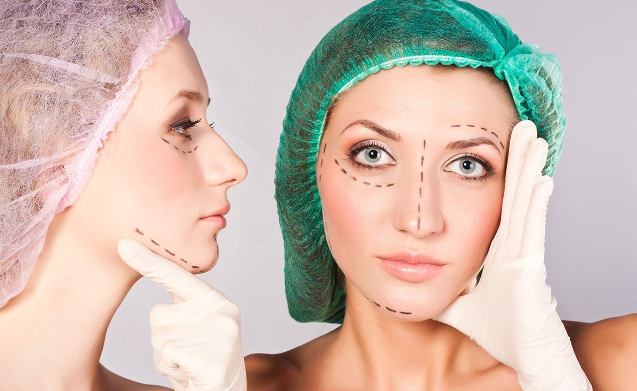 A facelift post-recovery in a time-lapse