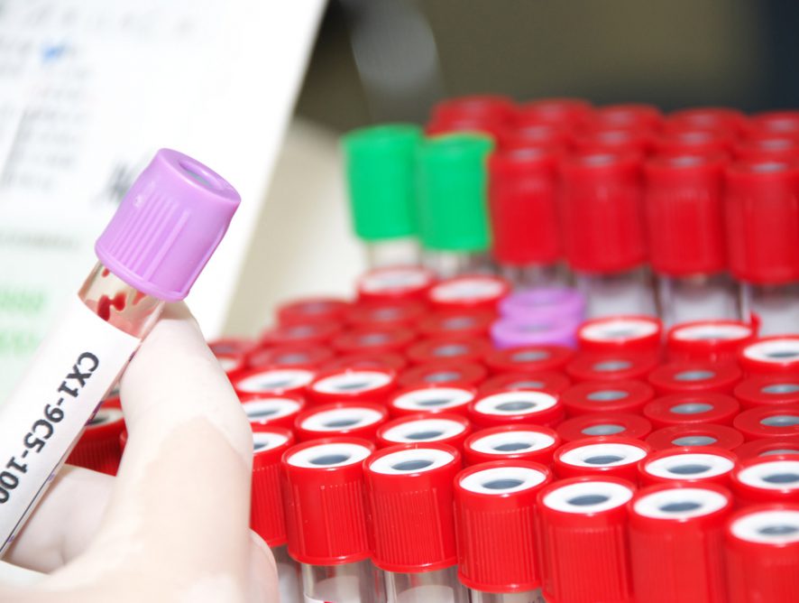 Pancreatic Cancer May Have Met Its Match